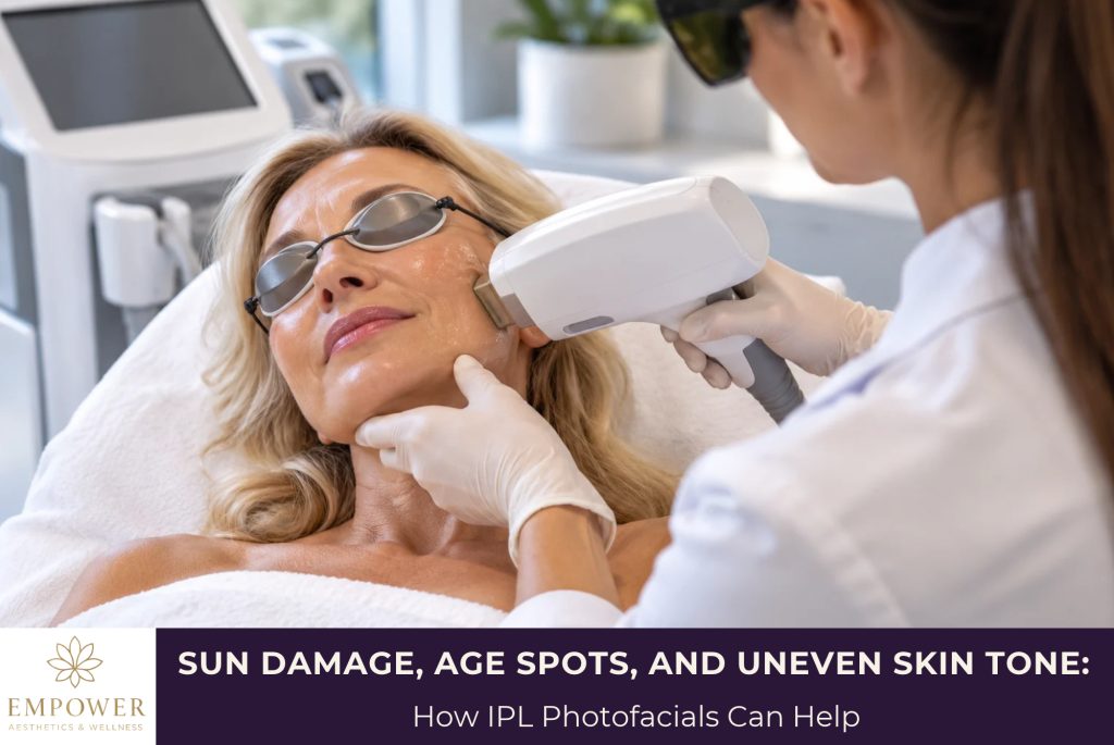 Sun Damage, Age Spots, and Uneven Skin Tone How IPL Photofacials Can Help