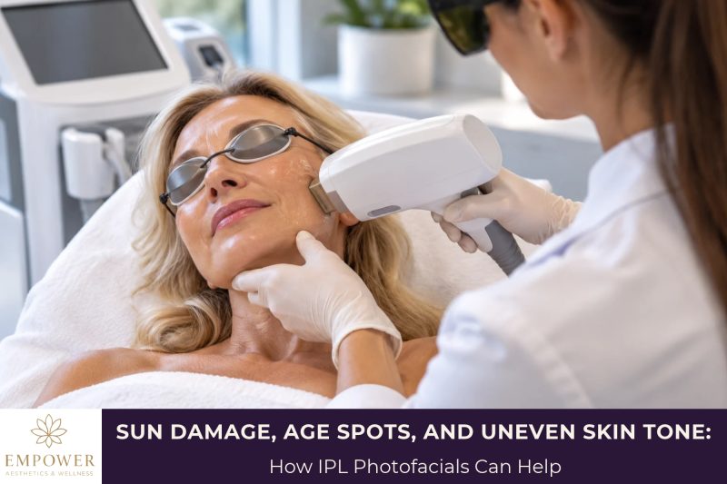 Sun Damage, Age Spots, and Uneven Skin Tone How IPL Photofacials Can Help