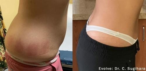 evolve-before-after-dr-c-sugihara-preview-2
