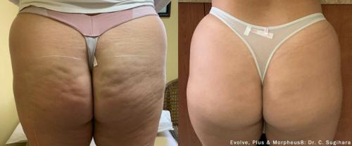 evolve-before-after-dr-c-sugihara-preview-3